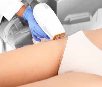 LASER HAIR REMOVAL NEAR AKRON OHIO