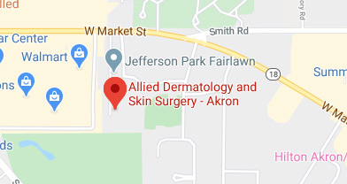 Allied Dermatology and Skin Surgery Akron location